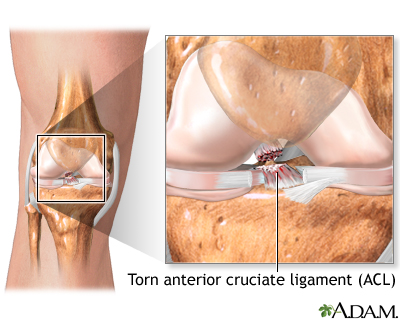 Indications Indications