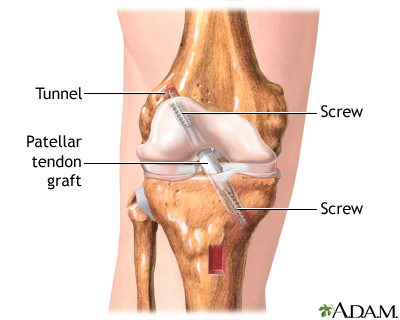 Procedure, part 2 Procedure, part 2