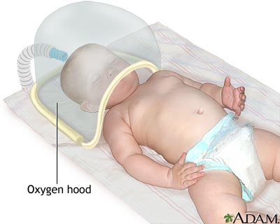 Oxygen hood Oxygen hood