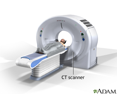 CT scan CT scan