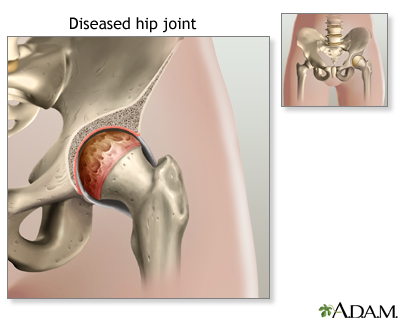 Indications Indications