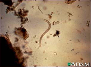 Hookworm rhabditiform larva Hookworm rhabditiform larva