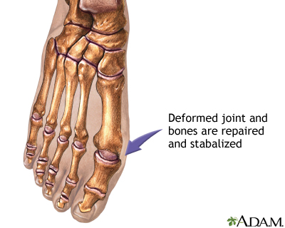 Procedure, part 2 Procedure, part 2