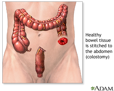Procedure, part 2 Procedure, part 2