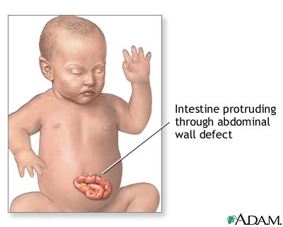 Indications Indications