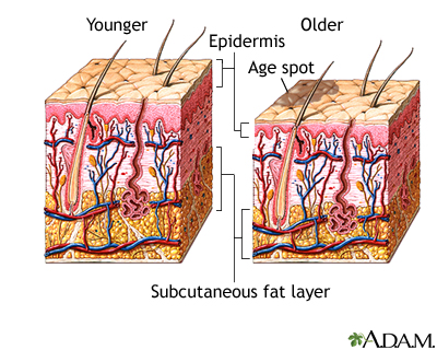 Changes in skin with age Changes in skin with age