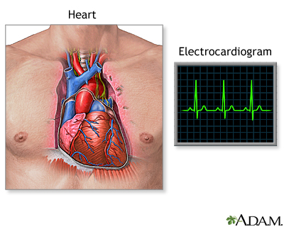 Electrocardiogram (ECG) Electrocardiogram (ECG)