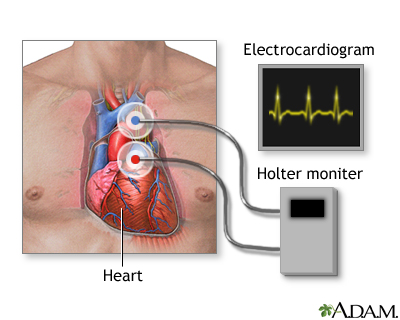 Holter heart monitor Holter heart monitor