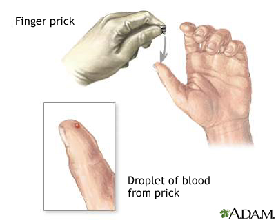 Capillary sample Capillary sample
