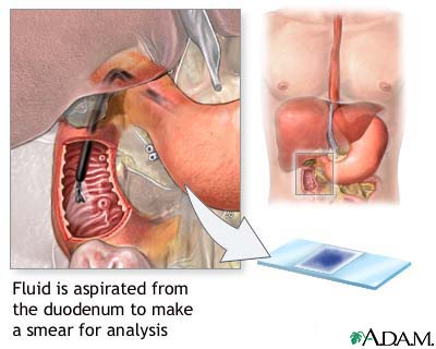 Duodenum tissue smear Duodenum tissue smear