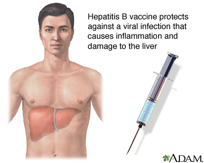 Hepatitis B Hepatitis B