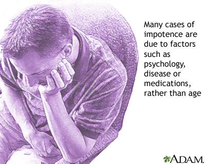 Impotence and age Impotence and age