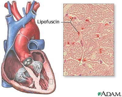 Lipofuscin Lipofuscin