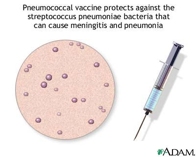 Pneumococcal vaccine Pneumococcal vaccine