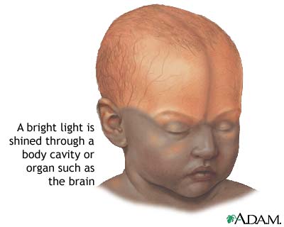 Infant brain test Infant brain test