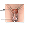 Male reproductive anatomy Male reproductive anatomy