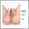 Anterior vaginal wall repair (surgical treatment of urinary incontinence) - series Anterior vaginal wall repair (surgical treatment of urinary incontinence) - series