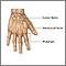 Repair of webbed fingers - series Repair of webbed fingers - series