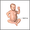 Umbilical hernia repair - series - Normal anatomy Umbilical hernia repair - series - Normal anatomy