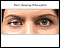 Ptosis - drooping of the eyelid Ptosis - drooping of the eyelid