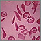 Red blood cells - multiple sickle cells Red blood cells - multiple sickle cells