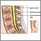 Lumbar spinal surgery - Series Lumbar spinal surgery - Series