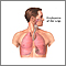 Lung transplant - series Lung transplant - series