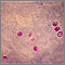 Cryptosporidium - organism Cryptosporidium - organism