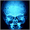 Eosinophilic granuloma - X-ray of the skull Eosinophilic granuloma - X-ray of the skull