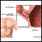 Achalasia - series Achalasia - series