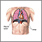 Pneumothorax - series - normal anatomy Pneumothorax - series - normal anatomy