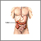 Colon diverticula - series Colon diverticula - series
