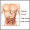 Inflammatory bowel disease - series Inflammatory bowel disease - series