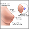 Breast self-exam Breast self-exam