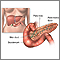 Pancreas