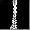 Vertebral column Vertebral column
