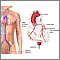 Coronary angiography Coronary angiography