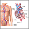 Left heart catheterization Left heart catheterization