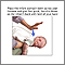 Heimlich maneuver on infant Heimlich maneuver on infant