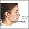 Facelift - series - Indications Facelift - series - Indications