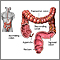 Large intestine (colon) Large intestine (colon)