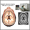 MRI of the brain MRI of the brain