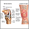 Knee pain Knee pain