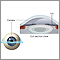 Lasik eye surgery - series - Normal anatomy Lasik eye surgery - series - Normal anatomy