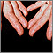 Amyloidosis of the fingers Amyloidosis of the fingers