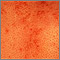 Sarcoid - close-up of the skin lesions Sarcoid - close-up of the skin lesions