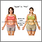 Different types of weight gain Different types of weight gain