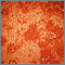 Pityriasis rubra pilaris - close-up Pityriasis rubra pilaris - close-up