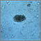 Hookworm egg Hookworm egg