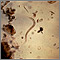 Hookworm rhabditiform larva Hookworm rhabditiform larva